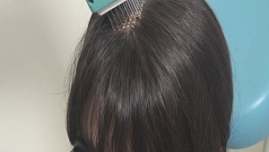 ÇOMÜ Tıp Fakültesi Hastanesi'nde Kozmetik Kliniği Açıldı