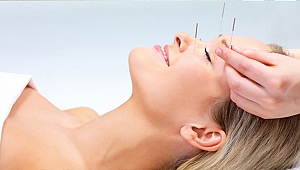 Migren Ağrılarına Akupunktur Engeli