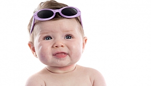 Renkli Gözlü Ve Beyaz Tenli Çocuklar Güneşe Dikkat!