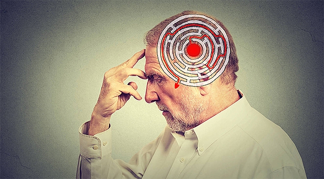 21 EYLÜL DÜNYA ALZHEIMER GÜNÜ