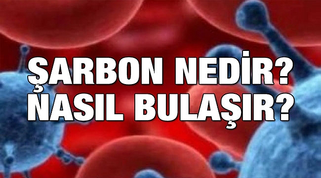 A'dan Z'ye Şarbon…