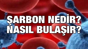 A'dan Z'ye Şarbon…