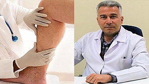 ÇOMÜ HASTANESİNDE VARİS TEDAVİSİNDE AMELİYATSIZ YÖNTEM