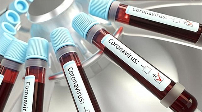 KORONAVİRÜSÜN YENİ BİR BELİRTİSİ DAHA AÇIKLANDI!