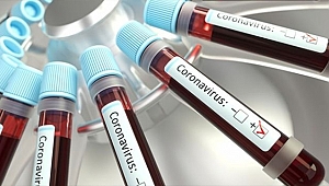 KORONAVİRÜSÜN YENİ BİR BELİRTİSİ DAHA AÇIKLANDI!