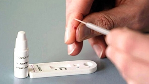 ÜLKEMİZDEKİ VAKA SAYISI ARTARKEN 13 KENTİMİZDE ANTİKOR TESTLERİ YAPILACAK!