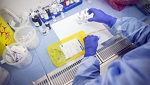 ÇANAKKALE'DE 52 BİN KİŞİYE KANSER TARAMASI YAPILDI