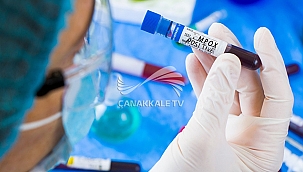 MAYMUN ÇİÇEĞİNE DİKKAT!